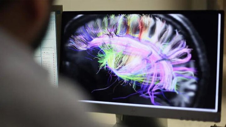 Eqoizmdən Xilas Olmaq Mümkündürmü? Alimlərdən şok Tədqiqat!