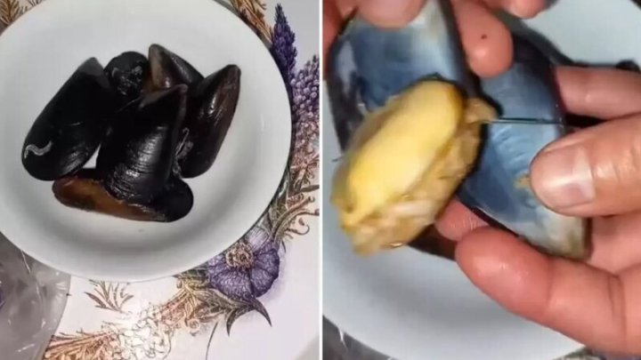 Midyənin Içindən çıxan Maddələr Izləyənləri şok Etdi: "Midyəyə Baxışımız Tamamilə Dəyişdi" - VİDEO Midyənin Içindən çıxan Maddələr Izləyənləri şok Etdi: "Midyəyə Baxışımız Tamamilə Dəyişdi" - VİDEO