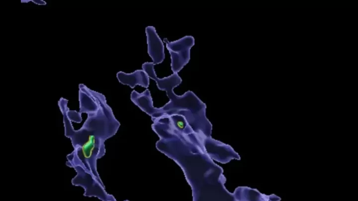 Mikroplastik İmmunitetə Zərər Verir: Alimlərdən Yeni Tədqiqat